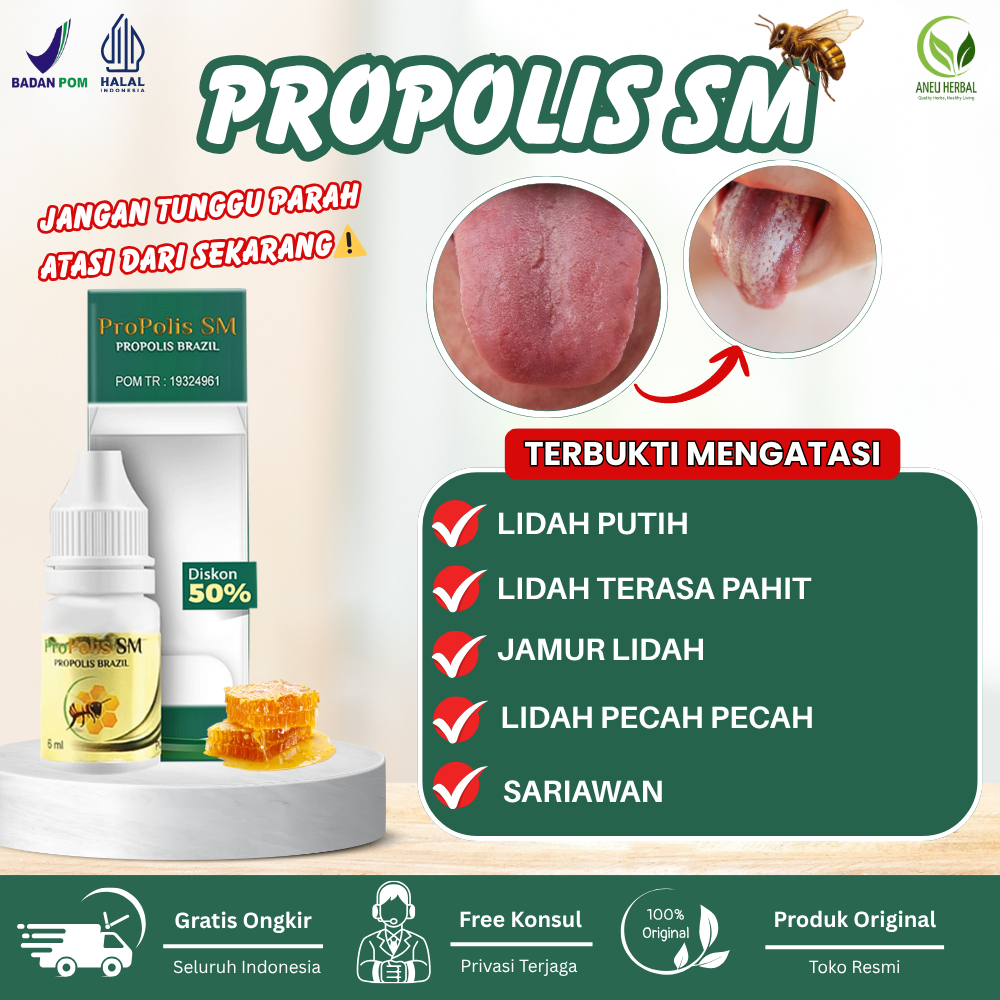 Propolis SM - Obat Penghilang Lidah Putih, Jamur Lidah, Lidah Pecah Pecah, Lidah Pahit