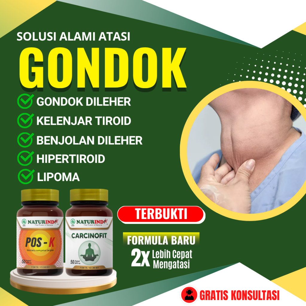 Obat Gondok Kelenjar Tiroid Hipertiroid Gondok Beracun Kista Tiroid Benjolan Di Leher Naturindo