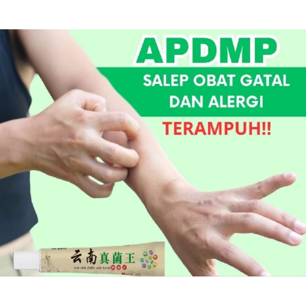 Salep Gatal Kulit Ampuh Salep Cina Gatel Exim Kulit Salep Psoriasis Eksim Obat gatal
