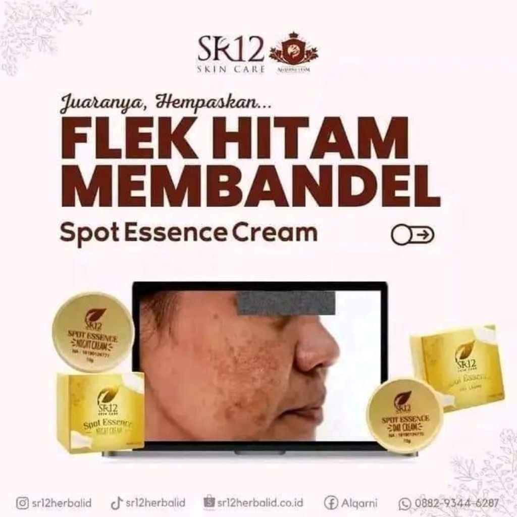 TERLARIS !! CREAM SPOT SR12/CREAM FLEK SR12/CREAM JERAWAT SR12