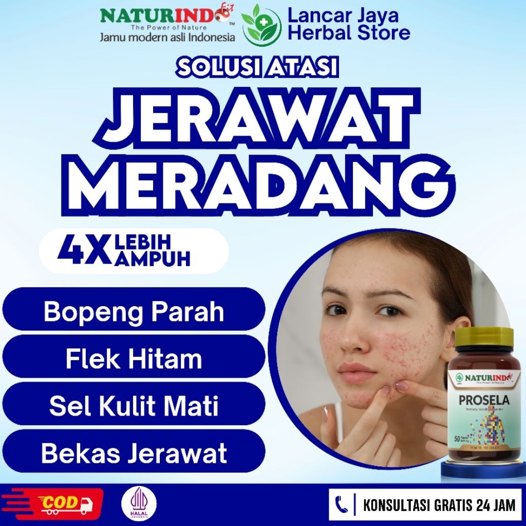 Obat Jerawat Meradang Bopeng Parah Flek Hitam Prosela Herbal Naturindo