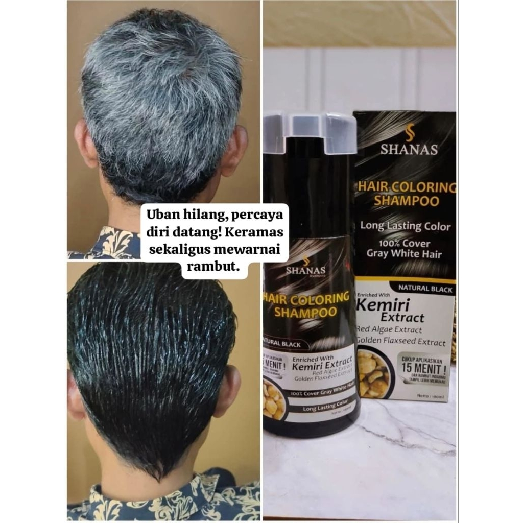 SHANAS SHAMPO ANTI UBAN/ SHAMPO PENGHITAM UBAN/SHAMPO UBAN HERBAL