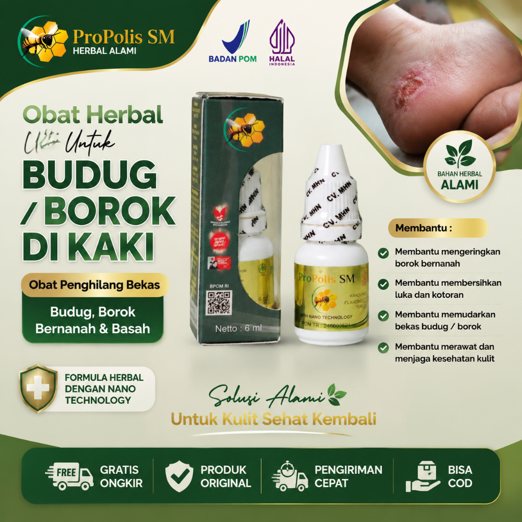 Obat Budug / Borok di Kaki, Obat Penghilang Bekas Budug Borok Bernanah Basah - Propolis SM