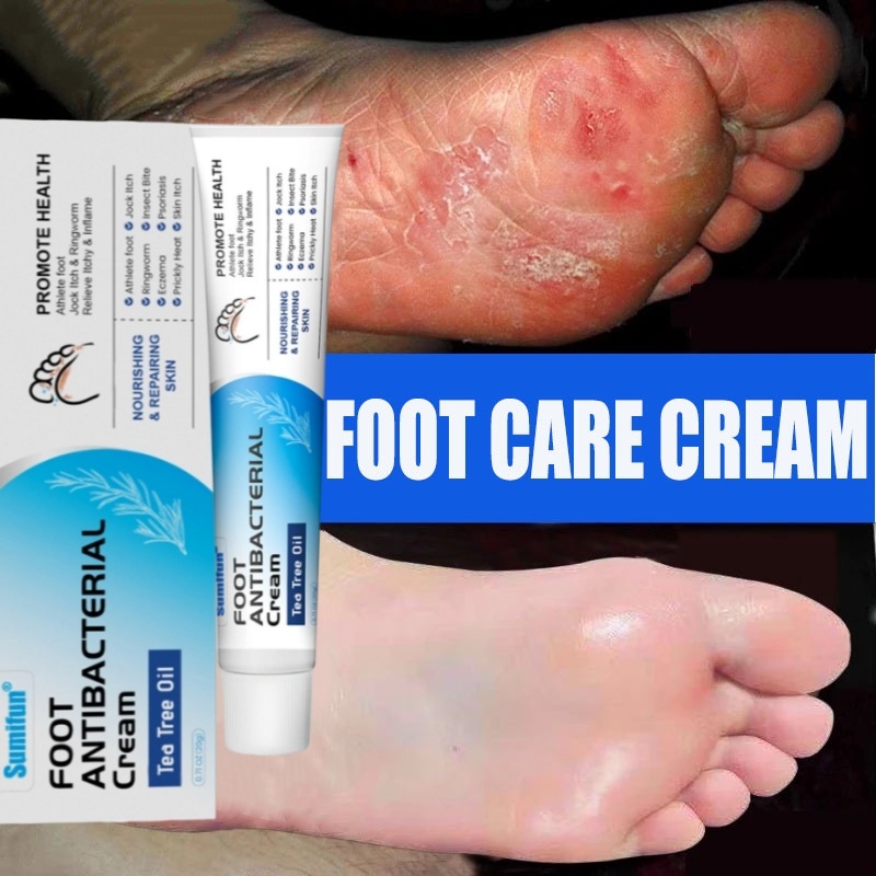 Salep kaki rayapan dan bau 0bat kaki rayapan Kaki gatal kering 0bat Jamur Kaki Salep kaki pecah peca