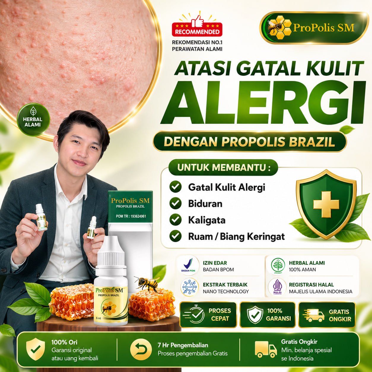 Propolis Sm - Obat Gatal Kulit Alergi Seluruh Badan, Obat Alergi Dingin, Biduran, Kaligata, Ruam Kul