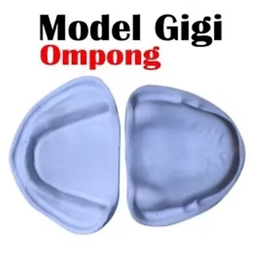 Model Gigi Ompong Bahan Gypsum