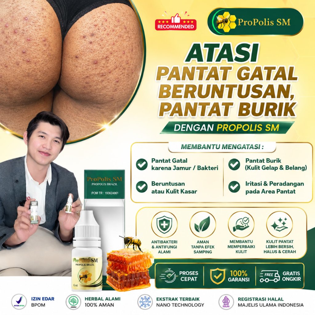 Obat Gatal Pantat|Obat Oles Pantat Burik|Obat gatal di pantat|penghilang gatal beruntusan di pantat|