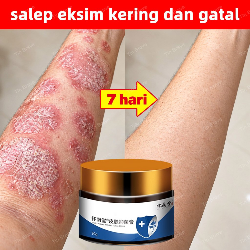 salep gatal china salep eksim kering dan gatal paling ampuh obat salep gatal selangkangan salep psor