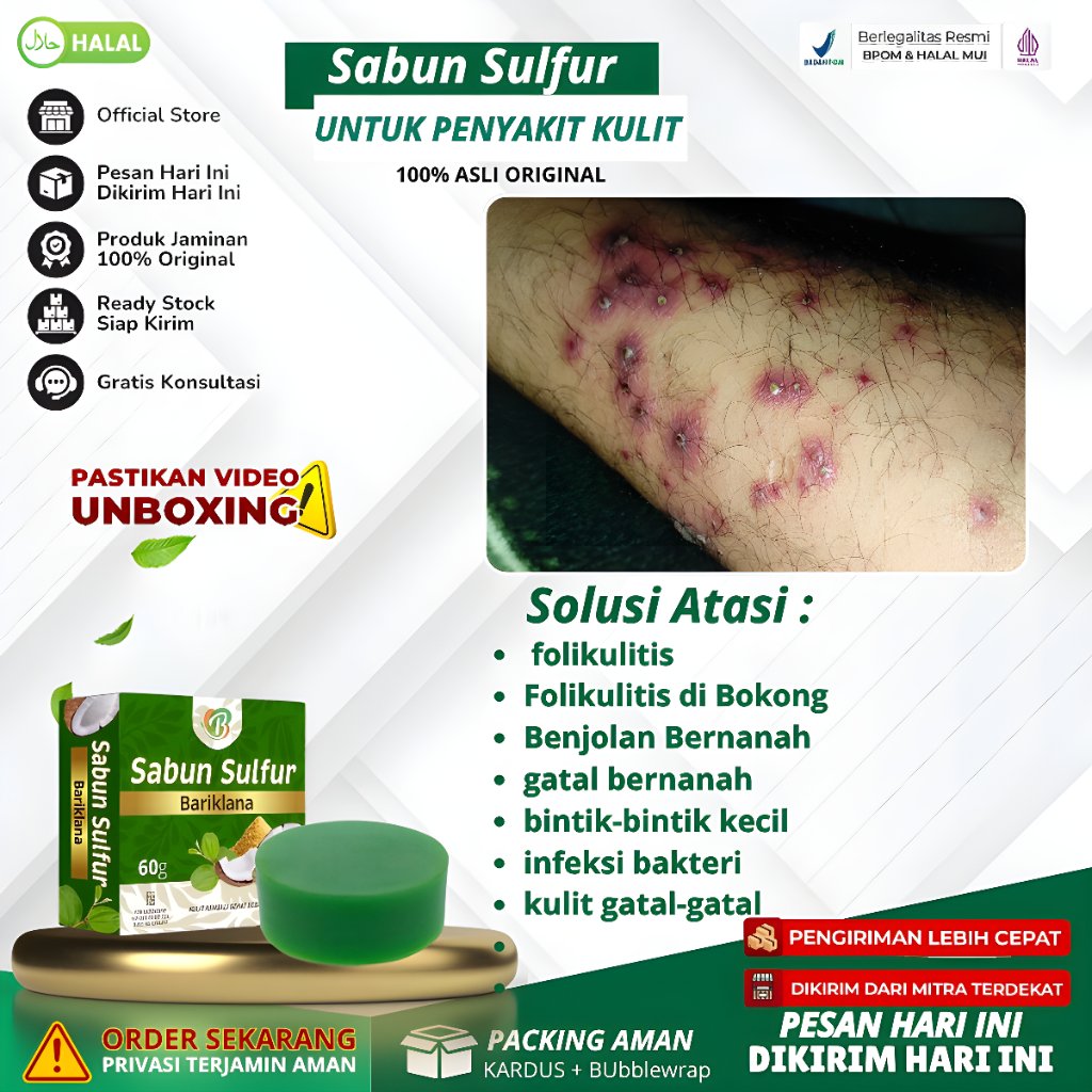 Sabun Sulfur Bariklana - Atasi Folikulitis, Folikulitis Di Bokong, Benjolan Bernanah, Gatal Bernanah