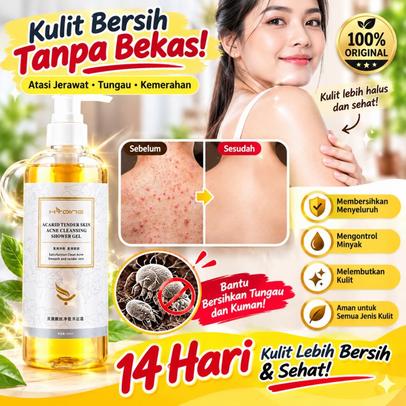 Eczema Body Wash 260ML Body Wash Acne Whitening Pengobatan Eksim Psoriasis Eksim Kering Kurap Gatal 