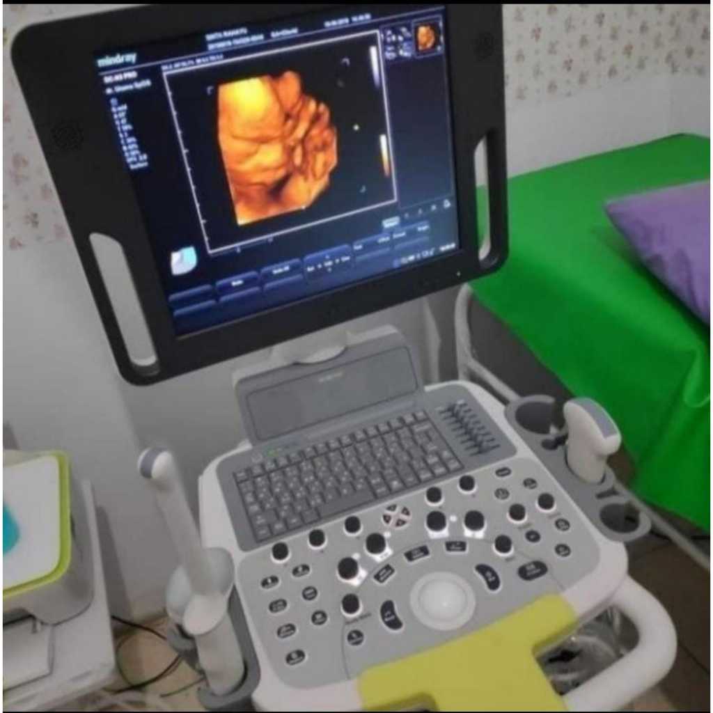 USG 4D Mindray DCN3PRO / USG 4d mindray dcn3pro