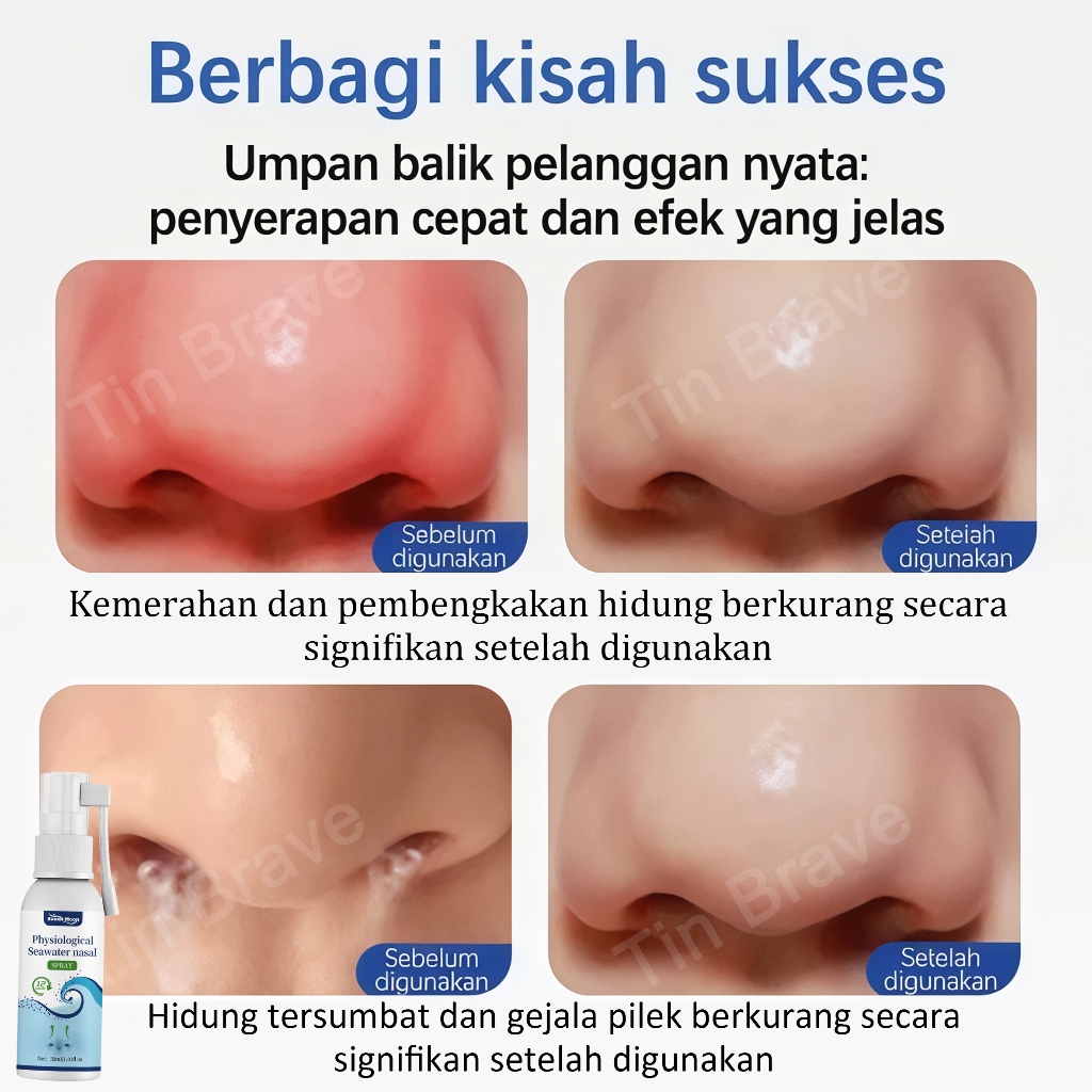 New nasal spray sinusitis semprot hidung obat sinusitis hidung tersumbat semprot hidung obat polip