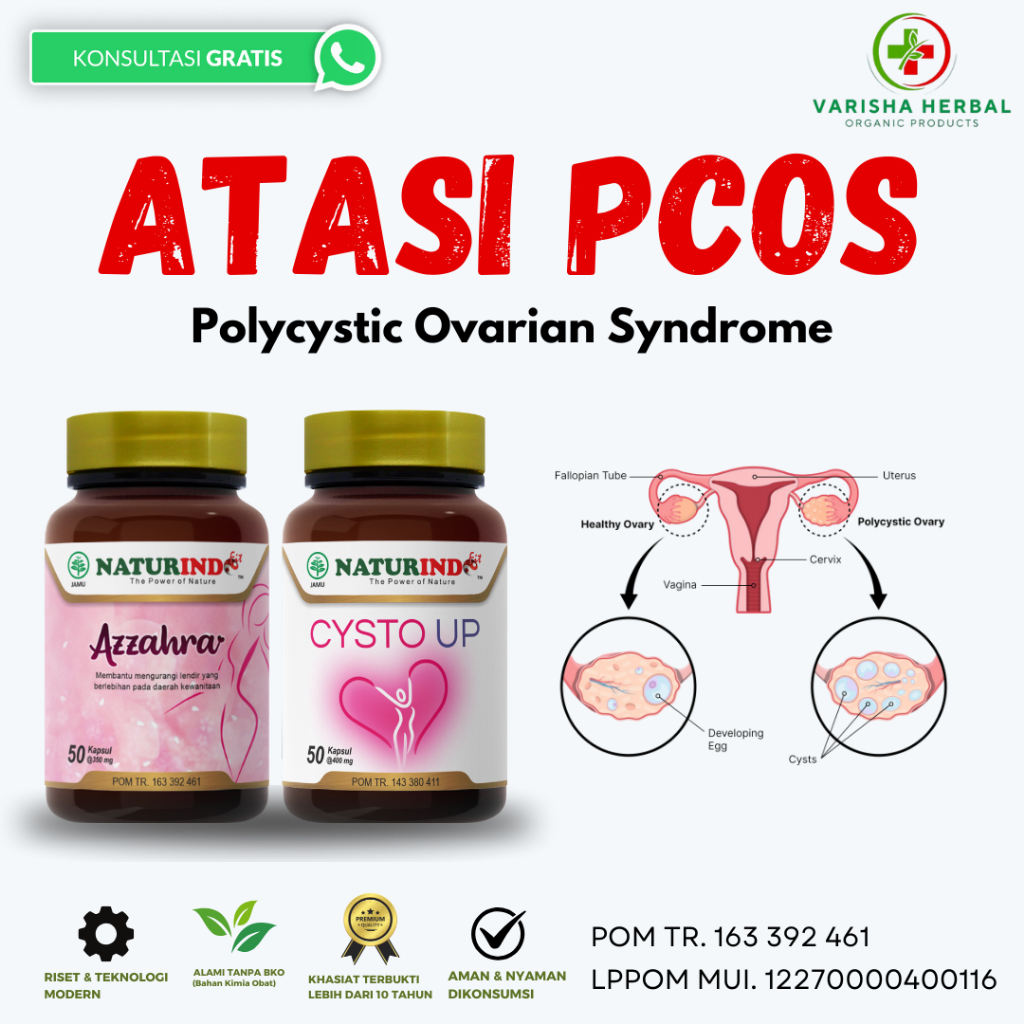 Obat Herbal PCOS Polycystic Ovarian Syndrome Sel Telur Kecil Cysto Up Azzahra Herbal Naturindo