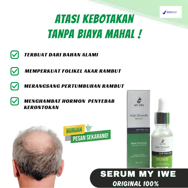 My Iwe Serum Perawatan Rambut Rontok Haircare Anti Hair Loss