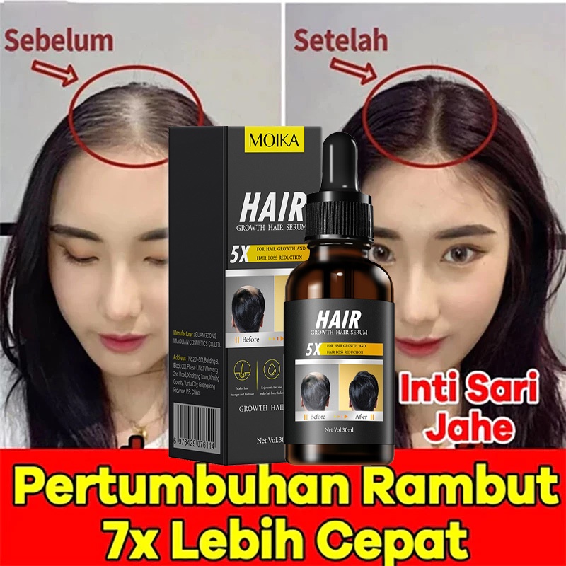 5x Serum Penumbuh Rambut 30ml Penumbuh rambut botak Kuat Anti Kering Kusam Bercabang Perawatan Rambu