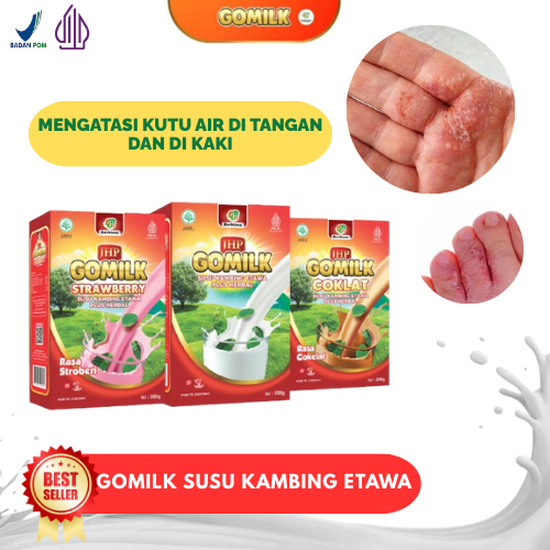 Obat Kutu Air, Penghilang Kuman Air, Gatal Berair, Kutu Air Pada Kaki, Jamur Kaki, Kutu Air Pada Sel