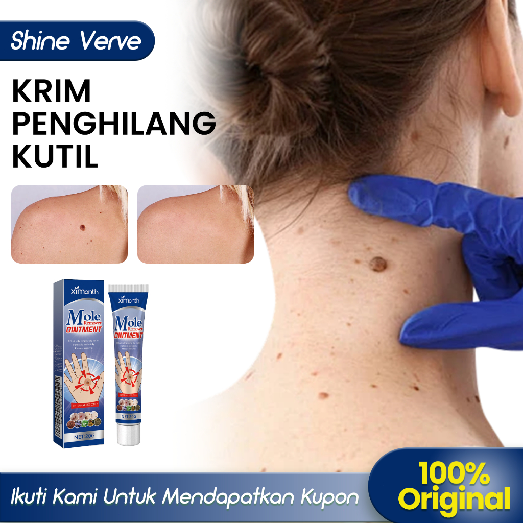 Ximonth| Beli 2 Gratis 1/Ori | Krim Penghilang Kutil Dan Yahi Lalat 20g Obat Kutil Paling Ampuh Krim
