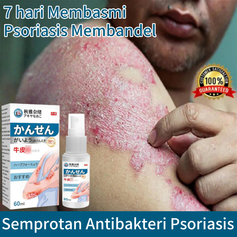 Obat gatal kulit Spray gatal paling ampuh Obat gatal gatal Obat gatal selangkangan Semprotan Anti Ga