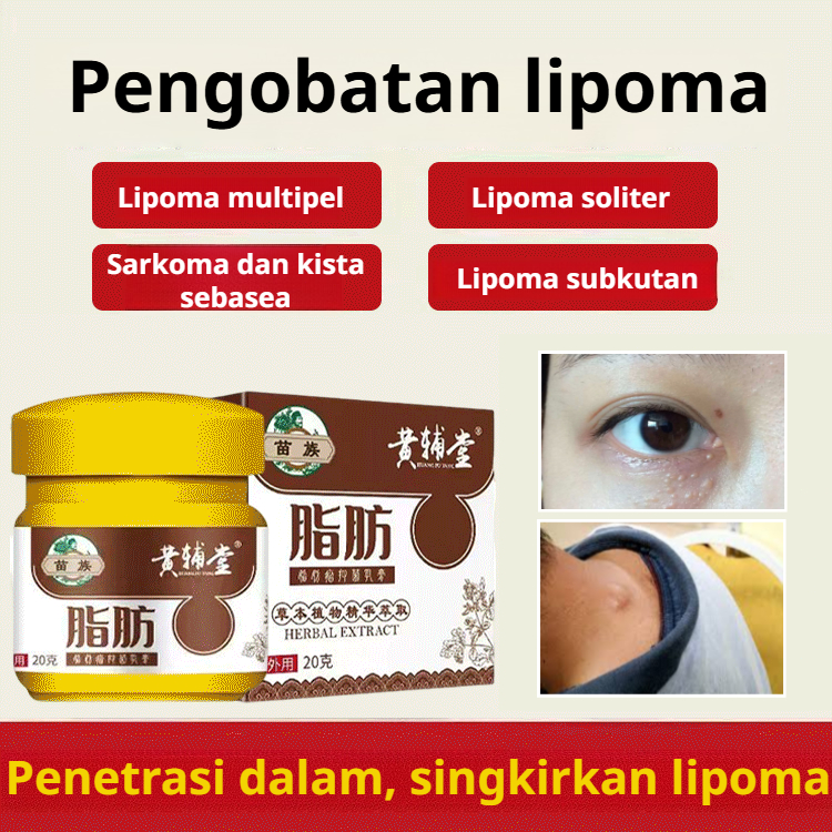 [Diskon Besar-besaran] Penghilang Lipoma | Obat Lipoma Alami | Oles Topikal | Penghilang Lipoma Cepa