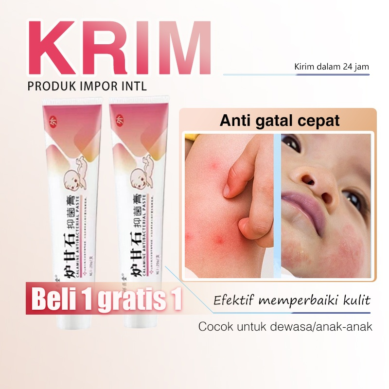 Krim Anti Gatal Anak 20G Salep Herbal Anak Obat Gatal Jamur Eksim Kudis Kutu Air Panu Psoriasis Herpes Dan Alergi