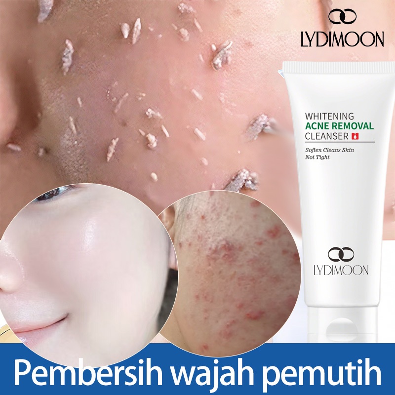 Sabun Wajah Pemutih dan Anti Jerawat facial wash facial foam pembersih wajah Madam Kulit Bebas Kusam