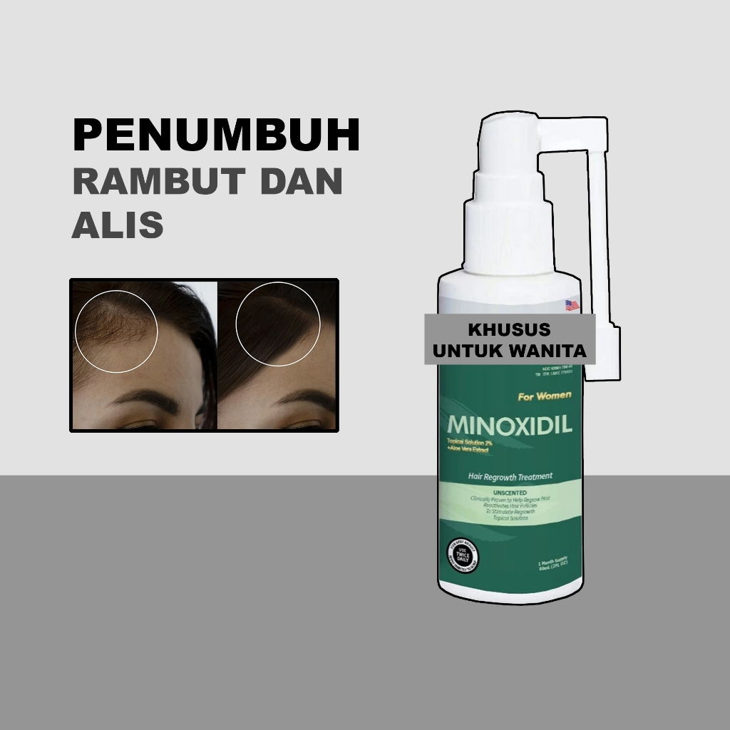 Minoxidil 2% Untuk Wanita Penumbuh Alis Rambut Kebotakan Kerontokan