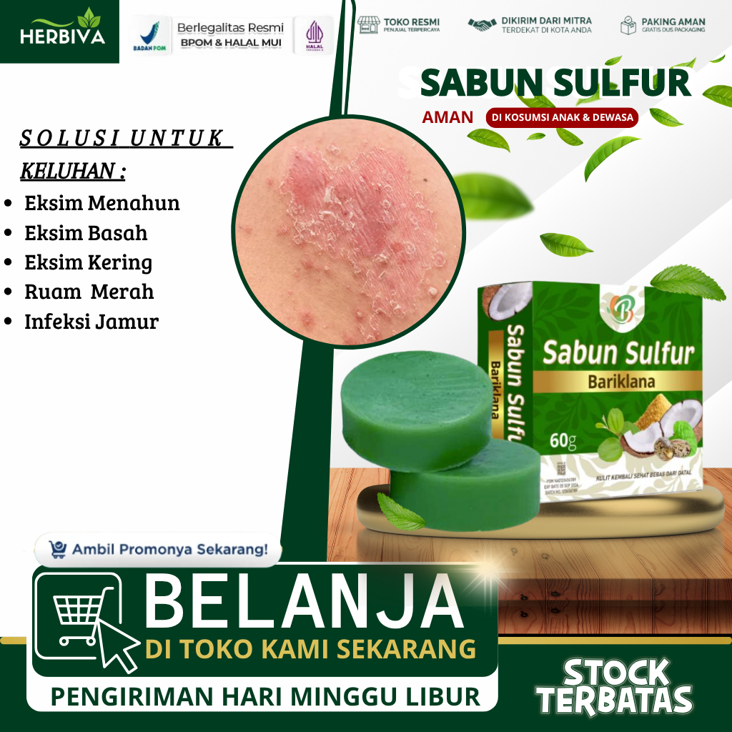 Sabun Sulfur Eksim Kering Menahun,Sabun Gatal Eksim,Eksim Gatal, Gatal Eksim Di Selangkangan,Eksim B