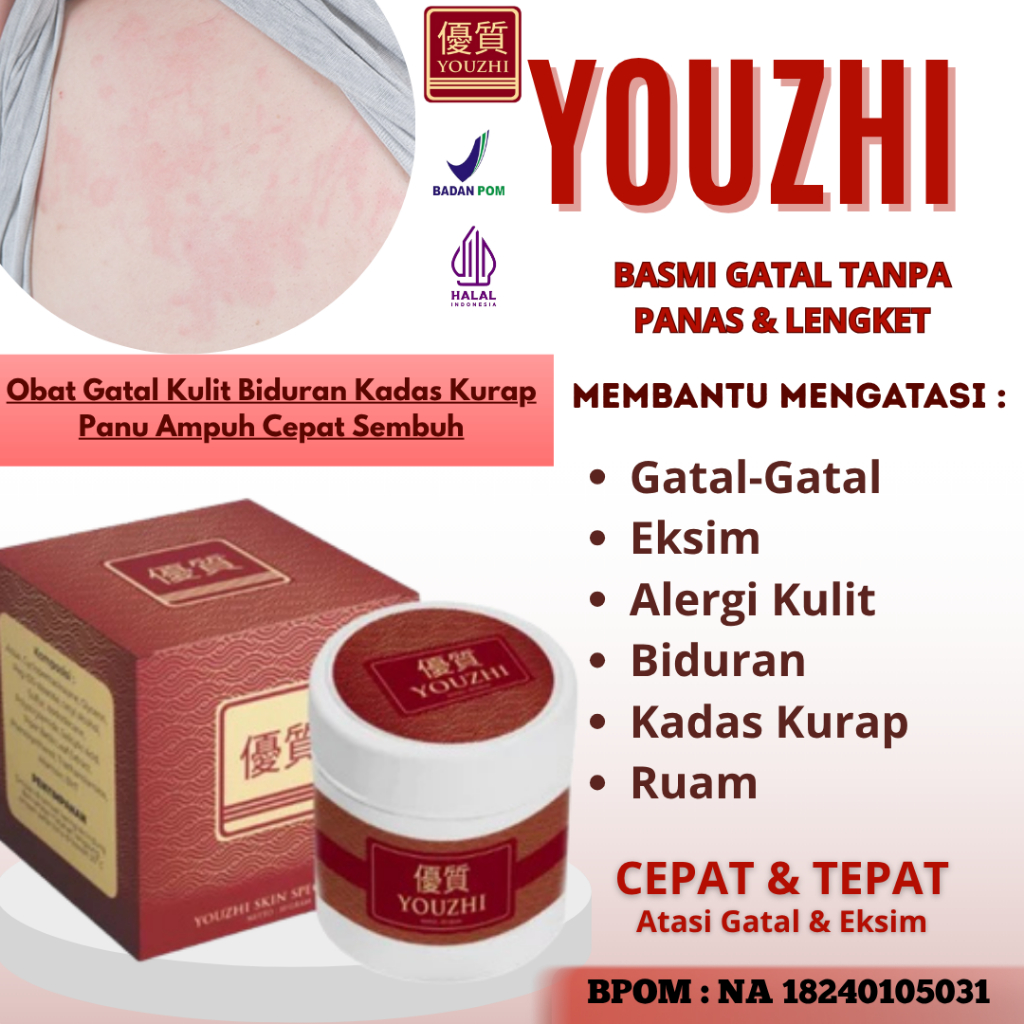 Salep Youzhi Original Obat Gatal Kulit Biduran Kadas Kurap Panu Ampuh Cepat Sembuh