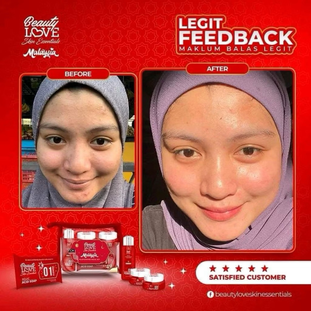 TERMURAH PAKET LENGKAP KRIM CREAM SET BEAUTYLOVE BL MALAYSIA BEAUTY LOVE JAMINAN ORIGINAL ASLI REJUV