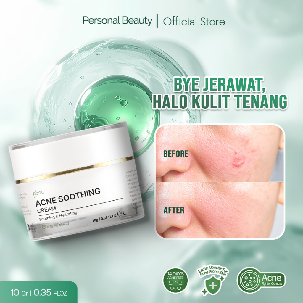 Personal Beauty Acne Soothing Cream - Soothing And Hydrating Acne Skin Moisturizer | Calming Acne