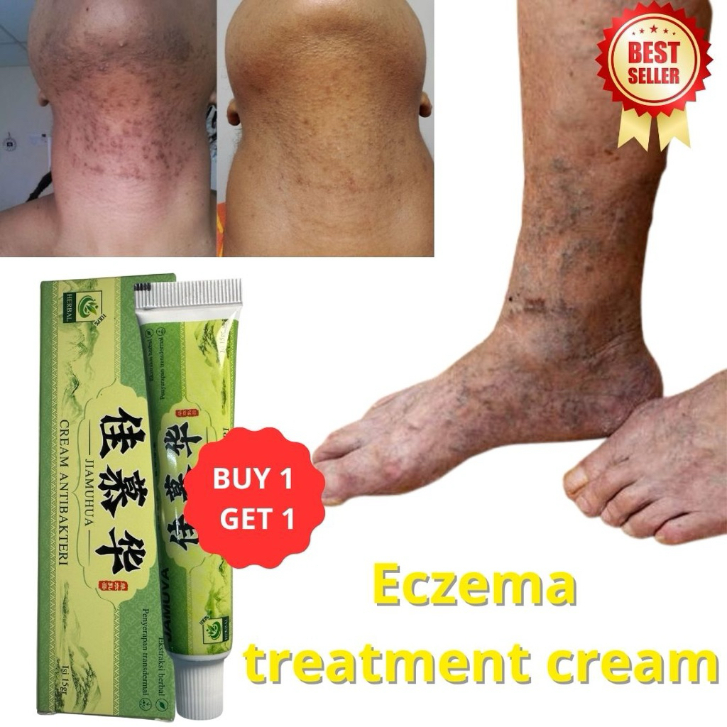 [BUY1GET1 HEMAT] Krim Salep Gatal JAMUVA Ampuh Atasi Alergi Merah Kulit Selangkangan Krim Asli Untuk
