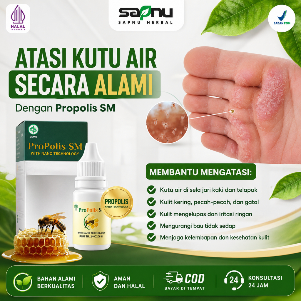 Obat Kutu Air, Kutu Air di Kaki, Kutu Air di Tangan, Kutu Air di Sela Kaki, Kutu Air Ruam Dan Gatal,