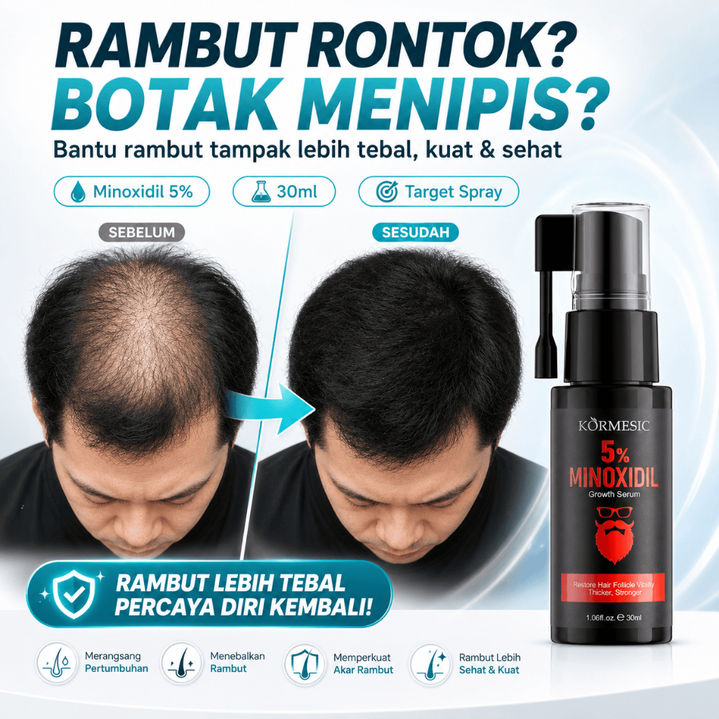 Serum Penumbuh Rambut Minoxidil 5 Persen Kormesic 30ml Hair Growth Serum Untuk Rambut Rontok Botak M