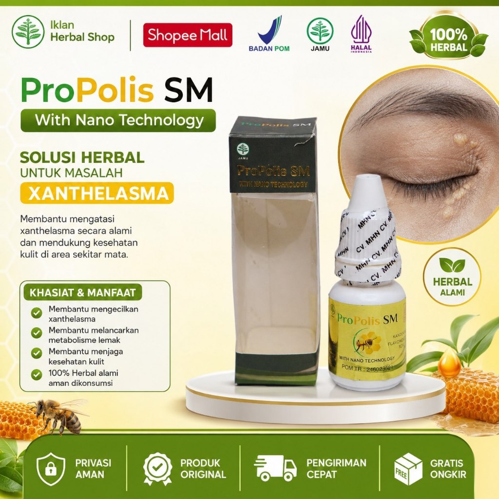Obat Gumpalan Lemak Di Kelopak Mata, Salep Penghilang Xanthelasma Milia Dekat Mata - Propolis SM