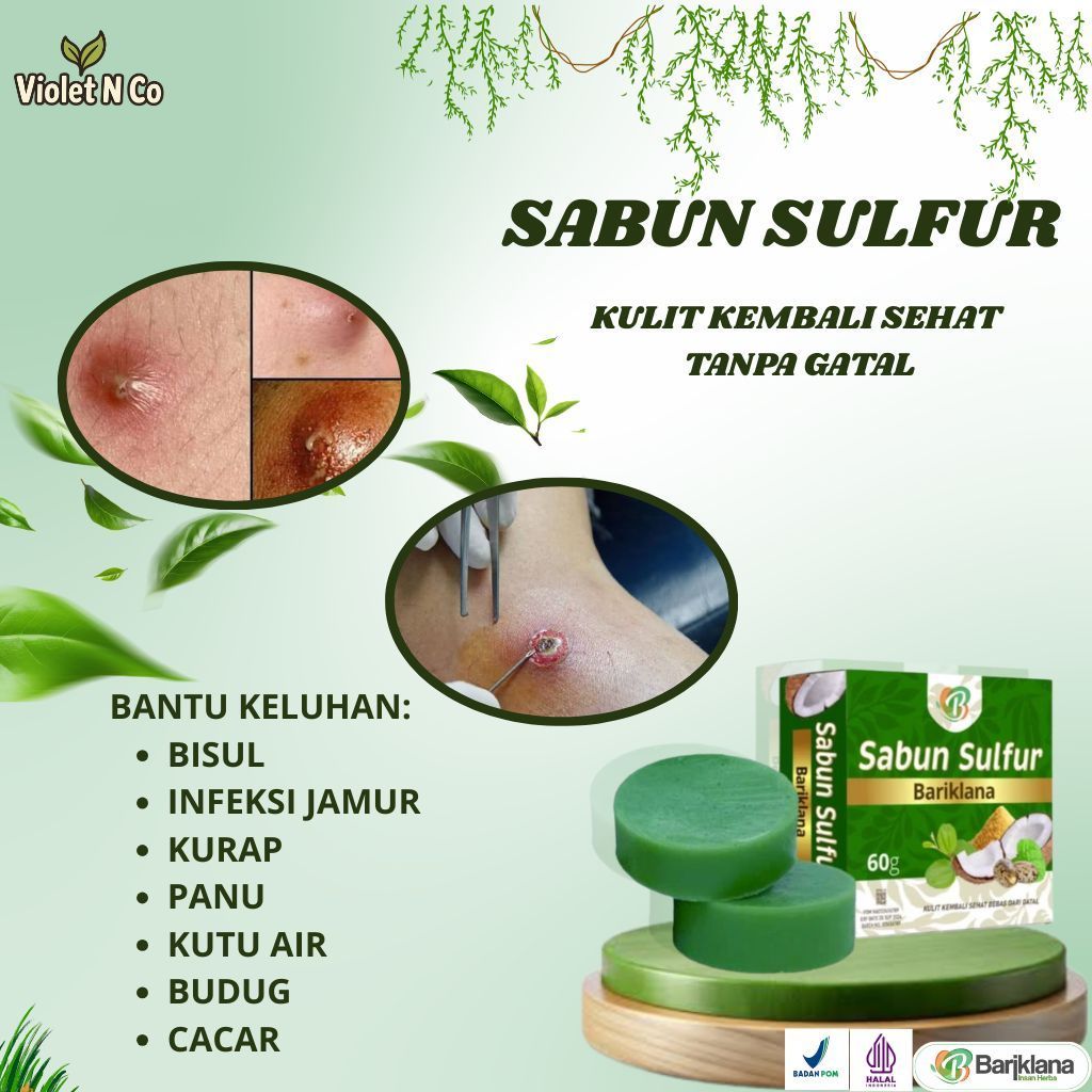 Sabun Sulfur - Obat Bisul, Obat Bisul Meradang, Obat Bisul Di Pantat, Obat Pengempes Bisul, Obat Bis