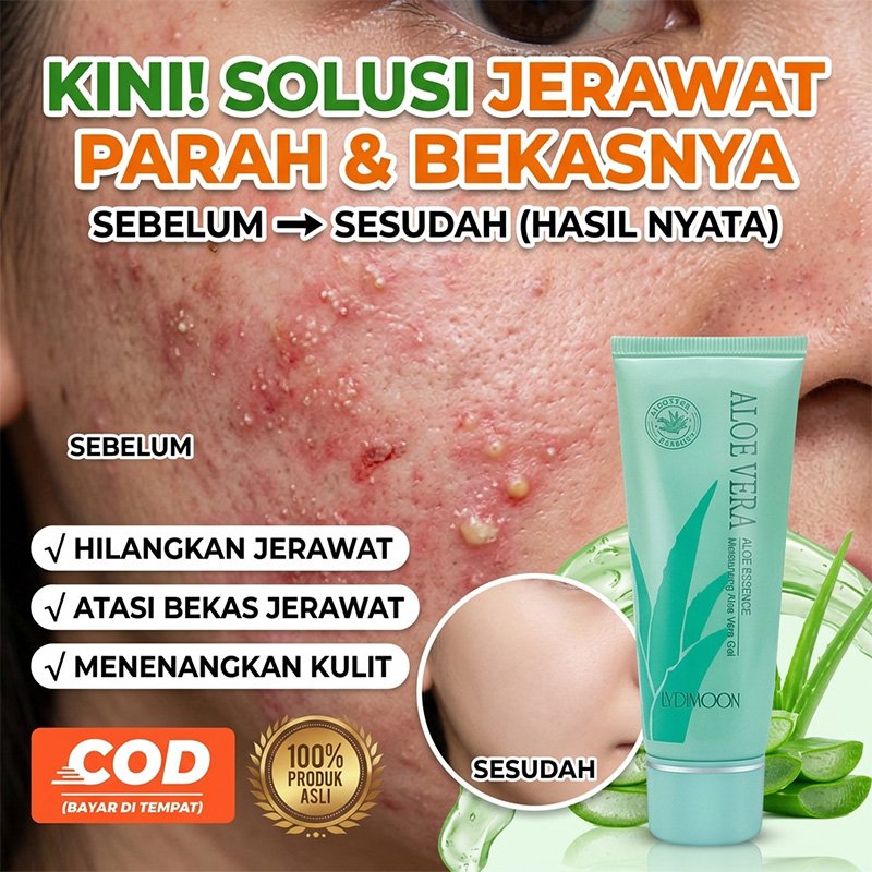 Aloe Vera Gel Krim Lidah Buaya ORI Pelembap Wajah dan Badan Perawatan Kulit Kering Bekas Jerawat Soo