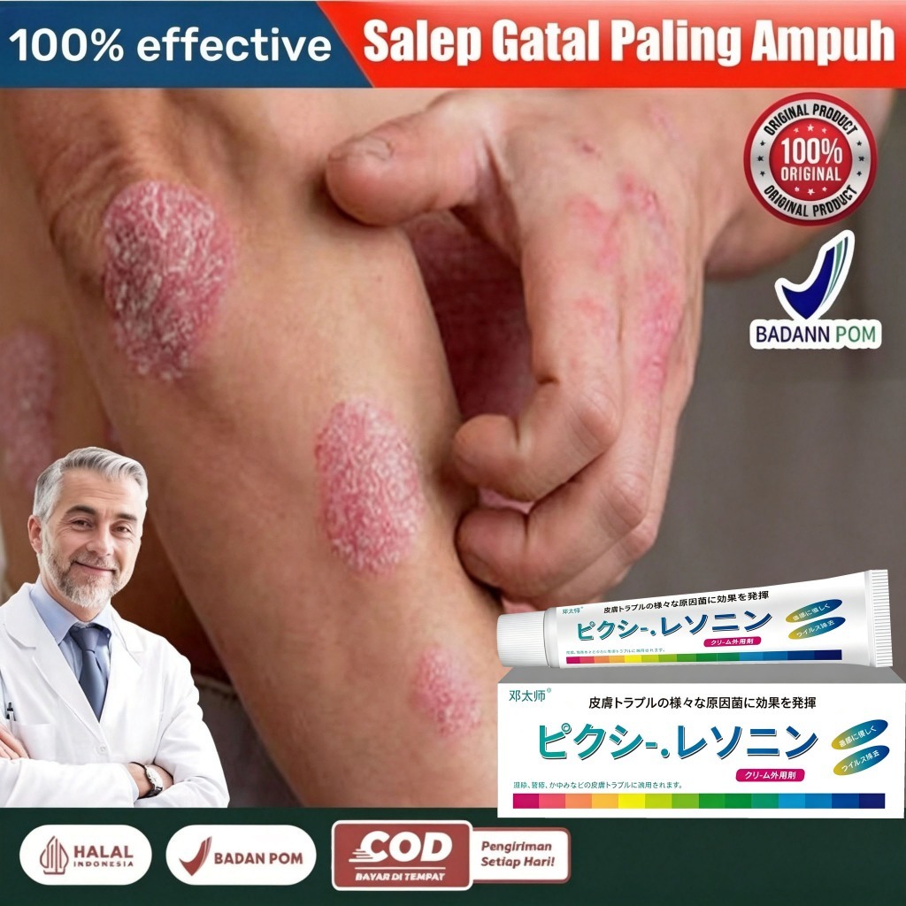 Psoriasis Cream Salep Eksim Salep Psoriasis Krim Anti EksimCepat Redakan Gatal Gatal Pada Kulit Meng