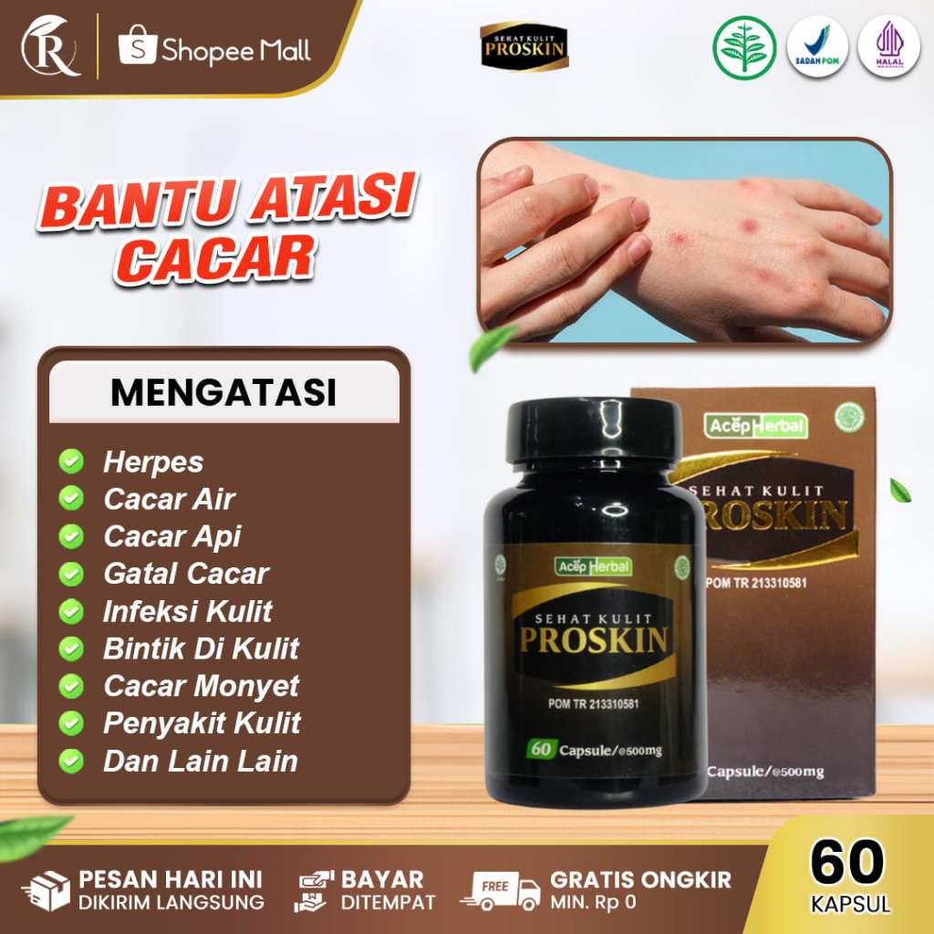 PROSKIN Obat Penghilang Cacar, Gatal Cacar Air, Cacar Api, Cacar Ular, Cacar Monyet, Panas Dingin