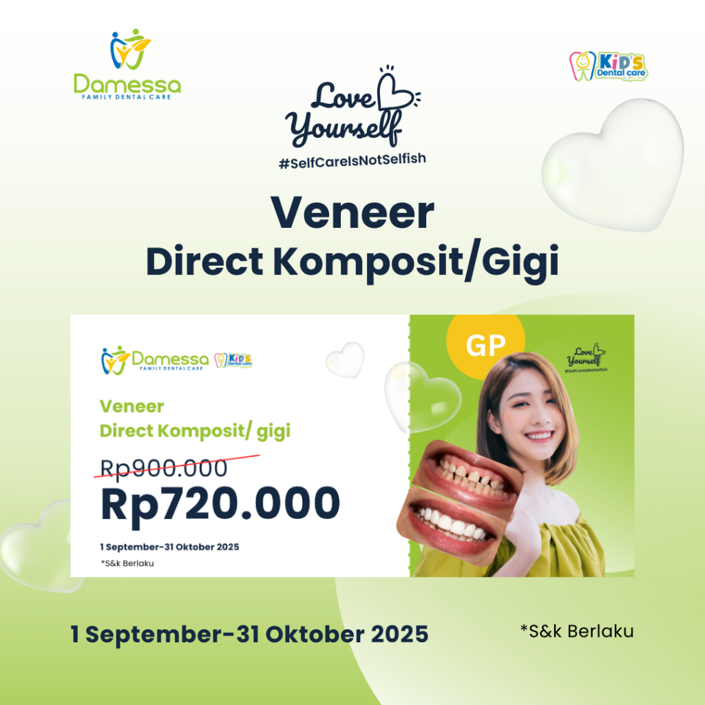 Voucher Veneer Direct Komposit/Gigi Dokter GP