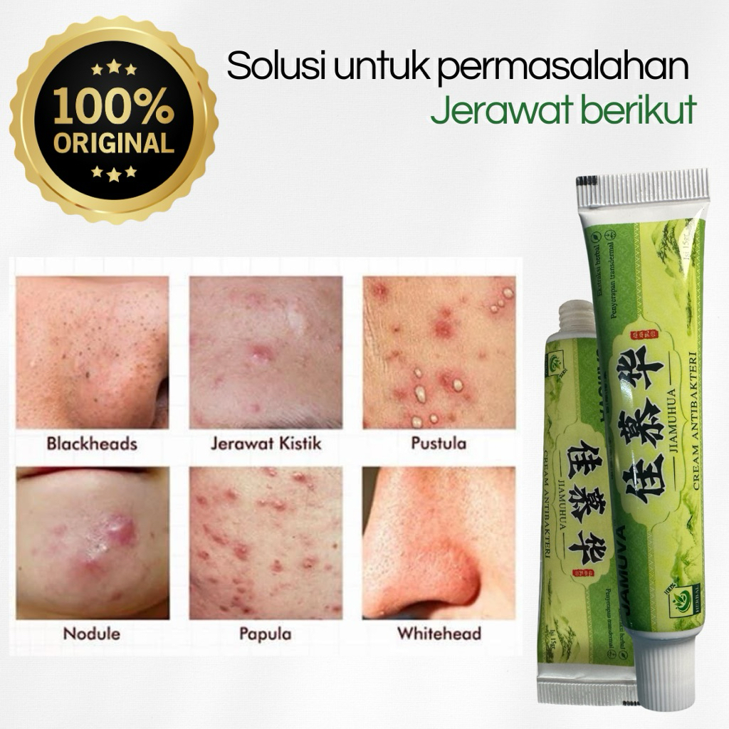 Salep Dermatitis | Salep Cream Jerawat | Salep Gatel Antibacterial | Obat Gatal Kulit