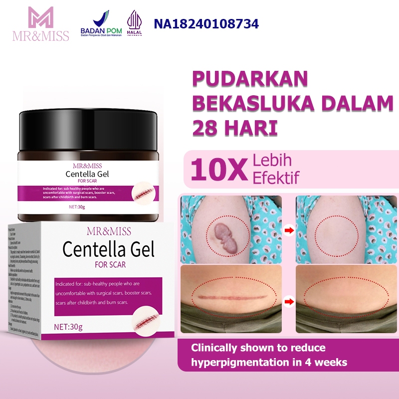 MR&MISS Salep keloid paling ampuh Penghilang keloid menonjol Salep keloid bekas operasi sc 30g