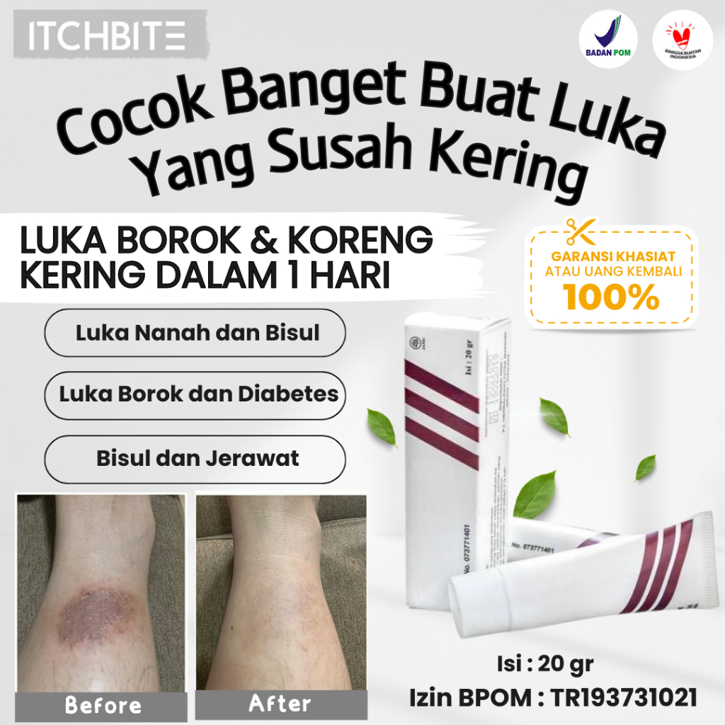 Salep Pengering Borok Luka Bernanah Basah Cacar Air Diabetes Korengan Koreng Paling Ampuh