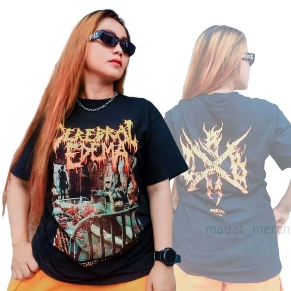 TSHIRT - CEREBRAL EDEMA -  Cerebral