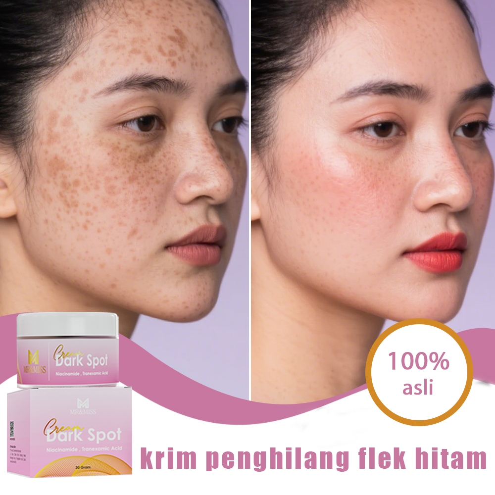 Cream penghilang flek hitam salep flek hitam membandel krim flek hitam membandel bpom ori 30g salep 