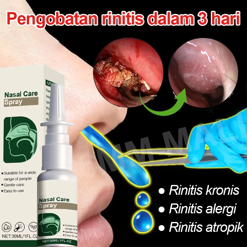 Nasal Spray Obat Sinusitis Semprotan Hidung Tersumbat Pembersih Hidung Sinusitis Obat Rinitis Breath