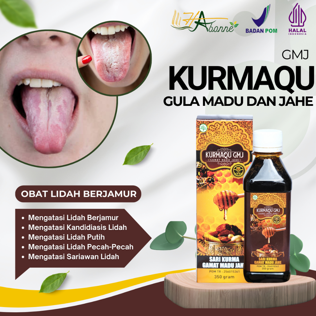 Obat Lidah Berjamur, Obat Kandidiasis Mukokutan, Obat Lidah Putih, Obat Lidah Pecah Pecah, Obat Lida