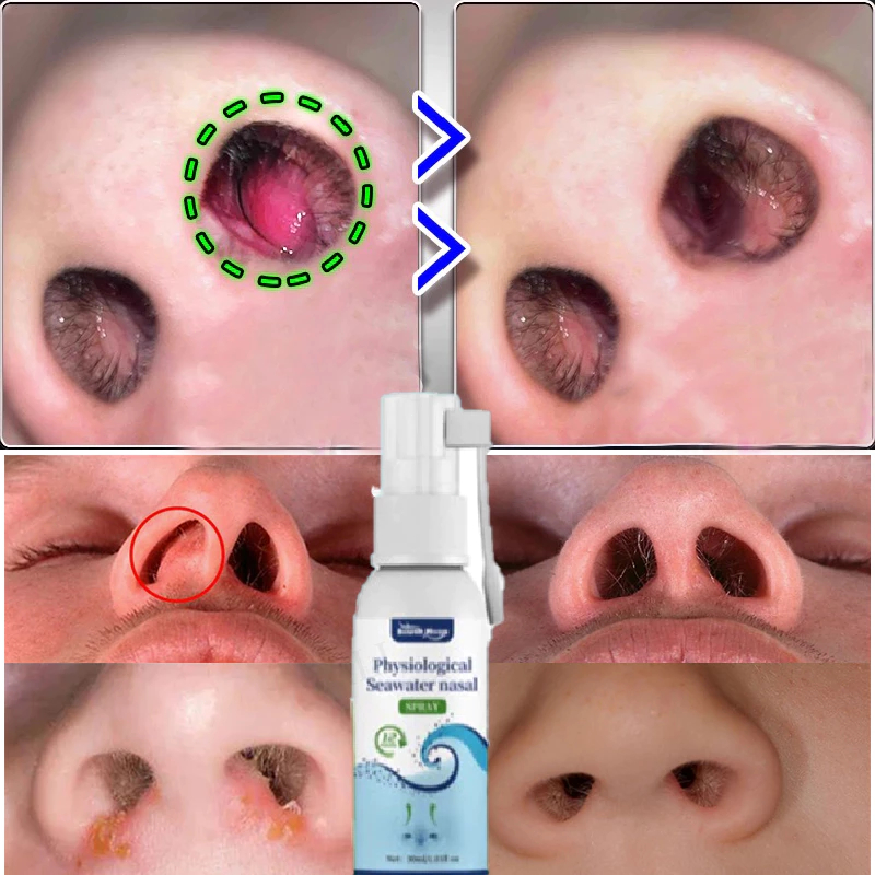 nasal care spray sinusitis semprot hidung 30ml nasalin semprot hidung obat polip pembersih hidung si