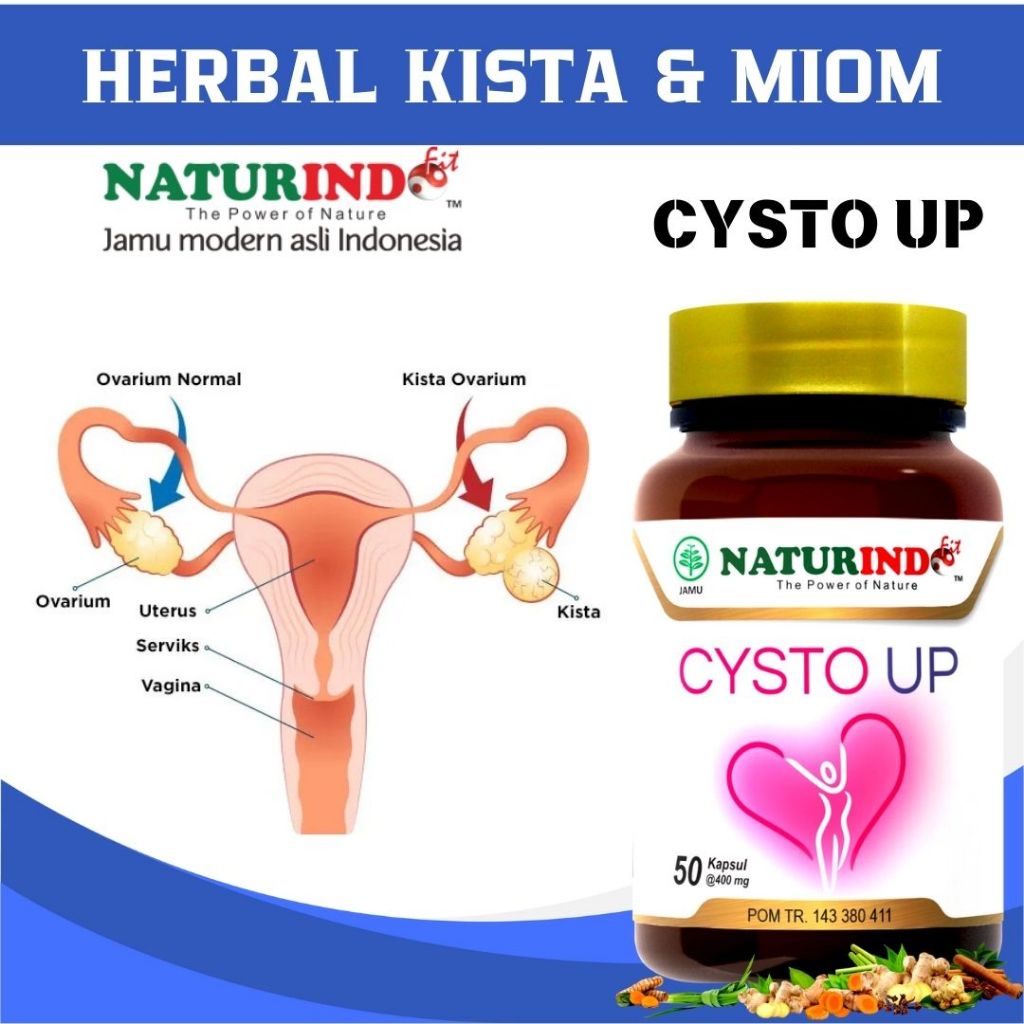 Kista Miom Bartholin Kista Ovarium Ganglion Endometriosis Penghancur Kista Miom Cysto Up Naturindo