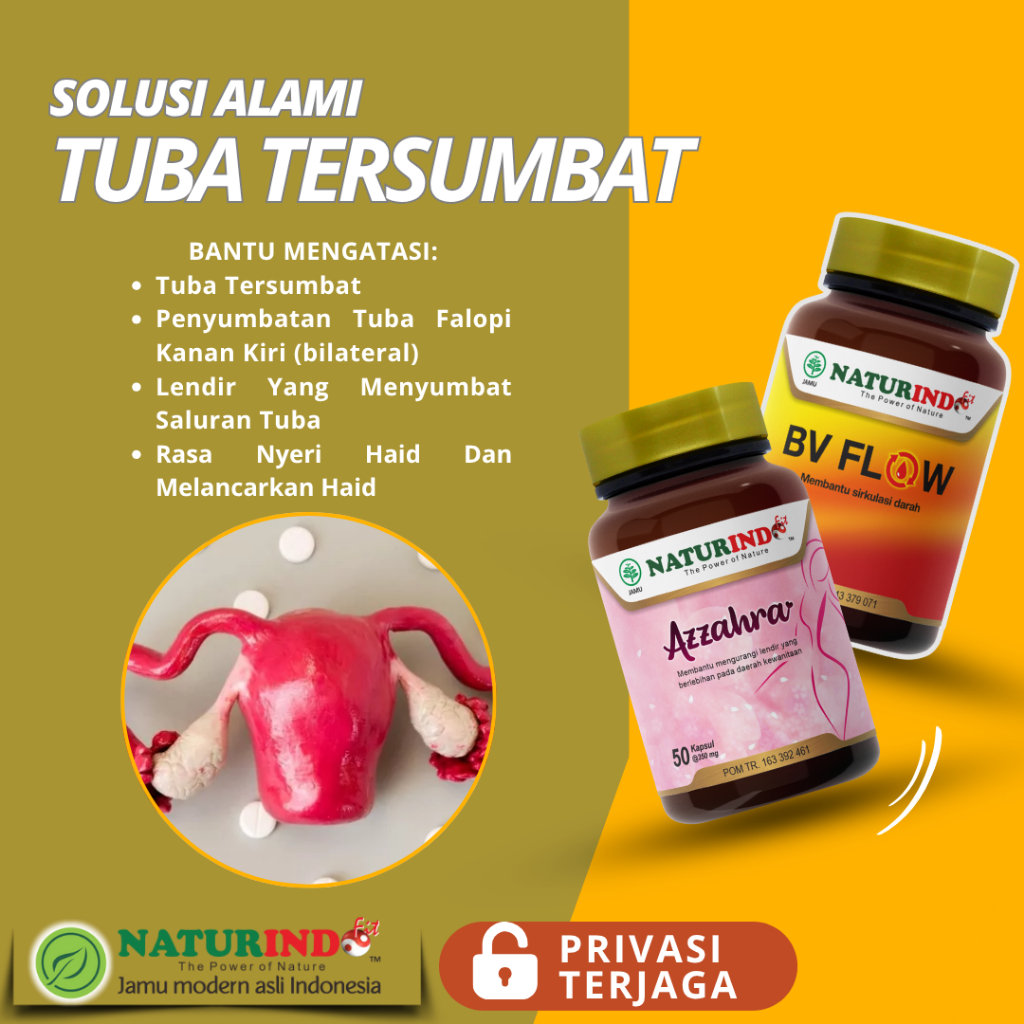 Herbal Tuba Fallopi Tersumbat Penyumbatan Saluran Tuba Fallopi Non-Paten Hidrosalping