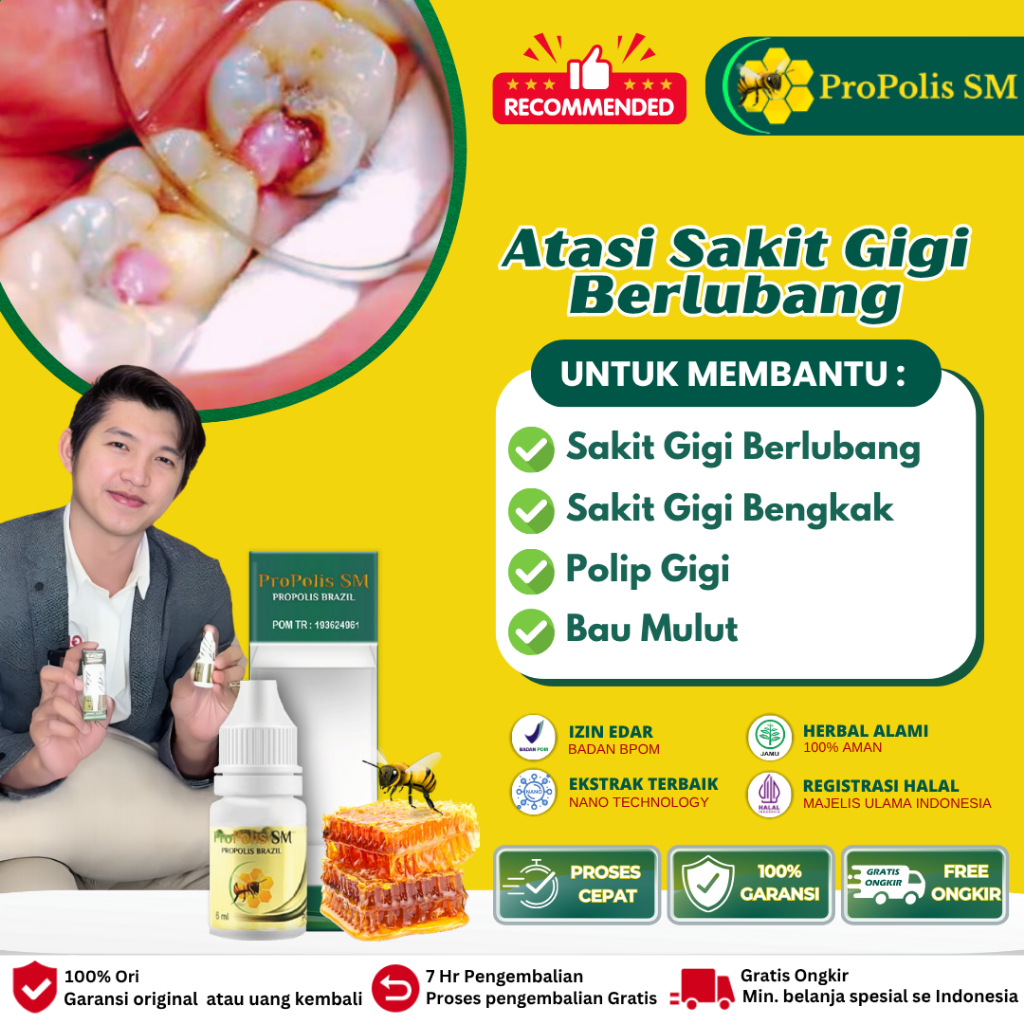 Propolis Sm Obat Sakit Gigi Nyeri Gigi, Obat Sakit Gigi Bengkak, Obat Sakit Gigi Berlubang Bolong Me